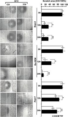 Corrigendum: Establishment of tumor treating fields combined with mild hyperthermia as novel supporting therapy for pancreatic cancer